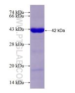 Recombinant human CEP110 protein Ag18907 proteintech