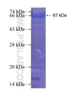 Recombinant human FGFR1OP protein Ag1891 proteintech