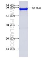 Recombinant human POF1B protein Ag1945 proteintech