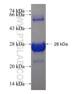 Recombinant human KDM2A protein Ag19467 proteintech