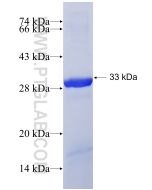 Recombinant human KIAA1524 protein Ag19598 proteintech