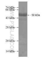 Recombinant human BCMO1 protein Ag19732 proteintech