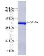 Recombinant human TTK protein Ag20556 proteintech
