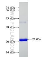 Recombinant human p504S,AMACR protein Ag20778 proteintech
