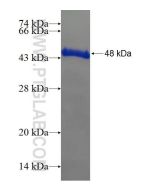 Recombinant human ARMC7 protein Ag21222 proteintech