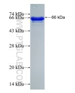 Recombinant human ANKS3 protein Ag21252 proteintech