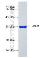 Recombinant human SOD2 protein Ag21388 proteintech