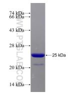 Recombinant human ARID4B protein Ag21485 proteintech