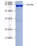 Recombinant human EVPL protein Ag22188 proteintech