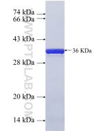 Recombinant human FAM9B protein Ag22560 proteintech