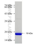 Recombinant human TIMP1 protein Ag22750 proteintech