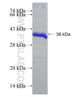 Recombinant human RIMKLB protein Ag23631 proteintech