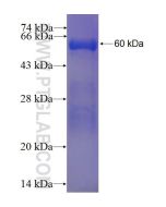 Recombinant human DCUN1D3 protein Ag23730 proteintech