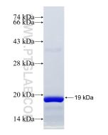 Recombinant human FCRL5 protein Ag24351 proteintech
