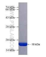 Recombinant human ALDH9A1 protein Ag24493 proteintech