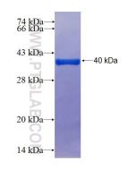 Recombinant human SH2D1A protein Ag2450 proteintech