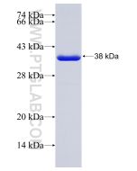 Recombinant human CAPG protein Ag24676 proteintech