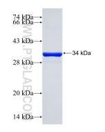 Recombinant human ELOVL5 protein Ag24896 proteintech