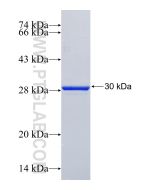 Recombinant human UNC119B protein Ag24916 proteintech