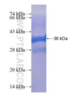 Recombinant human FLVCR2 protein Ag24928 proteintech
