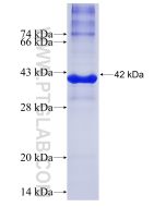 Recombinant human WNT2 protein Ag25185 proteintech