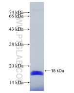 Recombinant human YTHDF1 protein Ag25347 proteintech