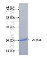 Recombinant human KCTD6 protein Ag25631 proteintech