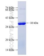 Recombinant human JAK3 protein Ag26186 proteintech