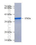 Recombinant human AS3MT protein Ag26194 proteintech
