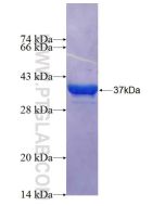 Recombinant human TMC2 protein Ag26366 proteintech