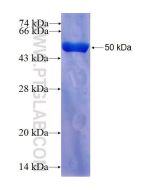 Recombinant human IFT74 protein Ag26385 proteintech