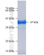 Recombinant human DPYD protein Ag26599 proteintech