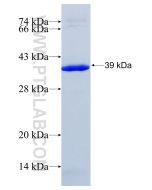 Recombinant human GDF15 protein Ag26790 proteintech