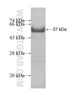 Recombinant human AP1M1 protein Ag2757 proteintech