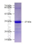 Recombinant human AGPAT5 protein Ag27782 proteintech