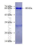 Recombinant human FBXO30 protein Ag27791 proteintech