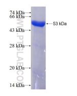 Recombinant human SMNDC1 protein Ag2822 proteintech