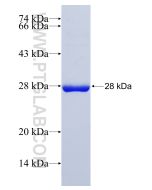 Recombinant human MAD2L2 protein Ag28233 proteintech
