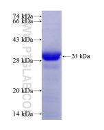 Recombinant human RNASET2 protein Ag28353 proteintech