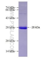 Recombinant mouse H2-K1 protein Ag28470 proteintech