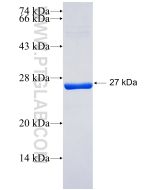Recombinant human PARK7,DJ-1 protein Ag28526 proteintech