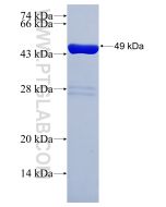Recombinant human CUX1 protein Ag28528 proteintech