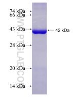 Recombinant human DOCK2 protein Ag28582 proteintech