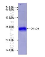 Recombinant human DUSP3 protein Ag28601 proteintech