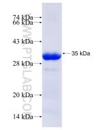 Recombinant human PMEPA1 protein Ag28777 proteintech