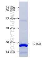 Recombinant human RLN2 protein Ag29076 proteintech