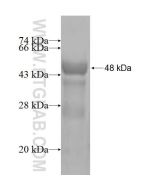 Recombinant human SSSCA1 protein Ag2916 proteintech