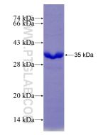 Recombinant human PDGFD protein Ag29199 proteintech