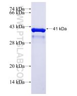Recombinant human GRIK5 protein Ag29363 proteintech