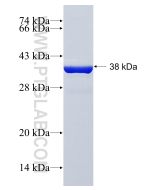 Recombinant human RPLP2 protein Ag29455 proteintech